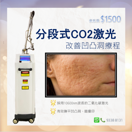 fractional CO2 laser 2