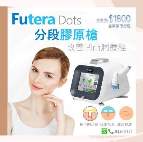 Futera Dots分段膠原槍