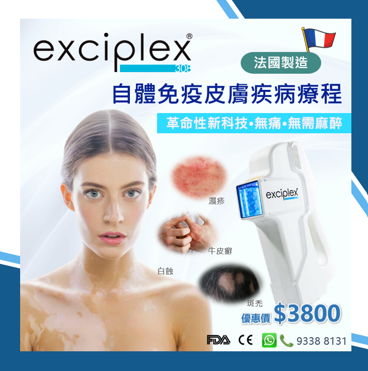 Exciplex