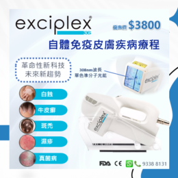 Exciplex