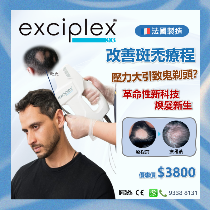 Exciplex