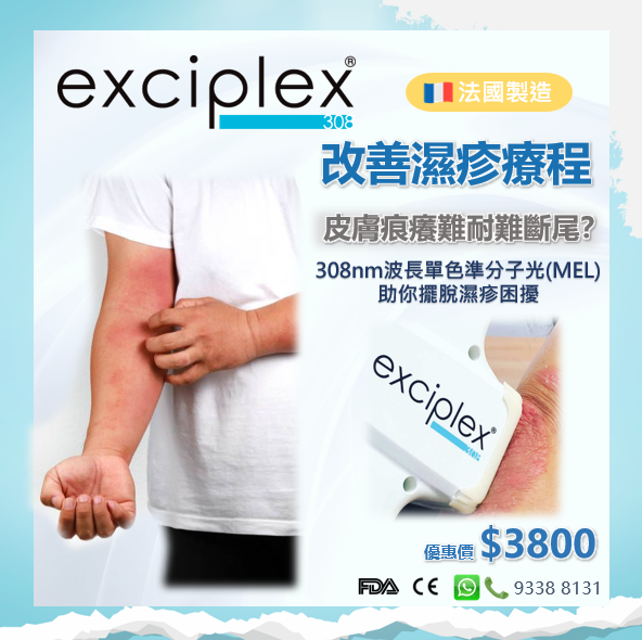 Exciplex