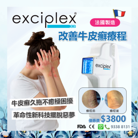 Exciplex