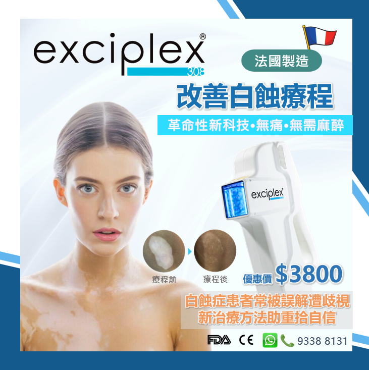 Exciplex