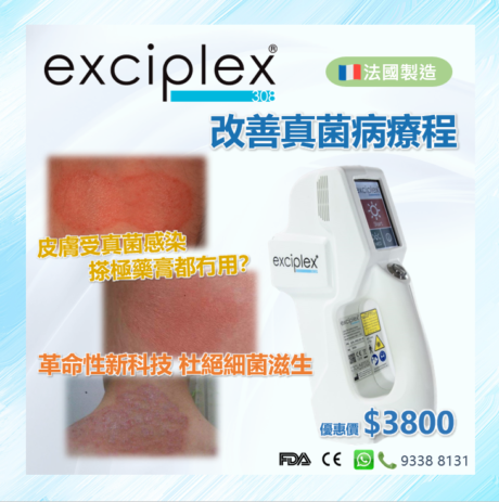 Exciplex